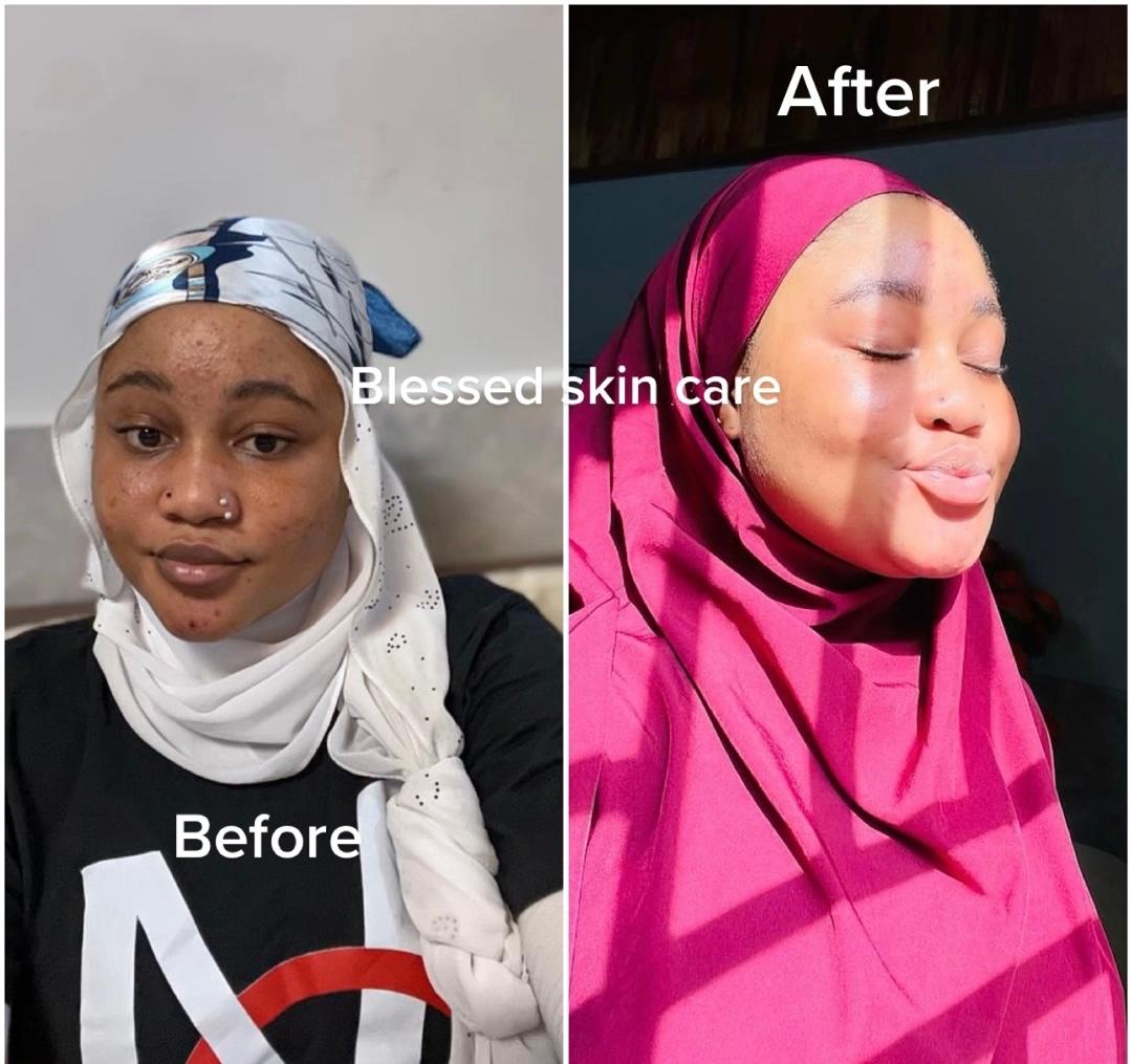 Skin Repair & Recovery
